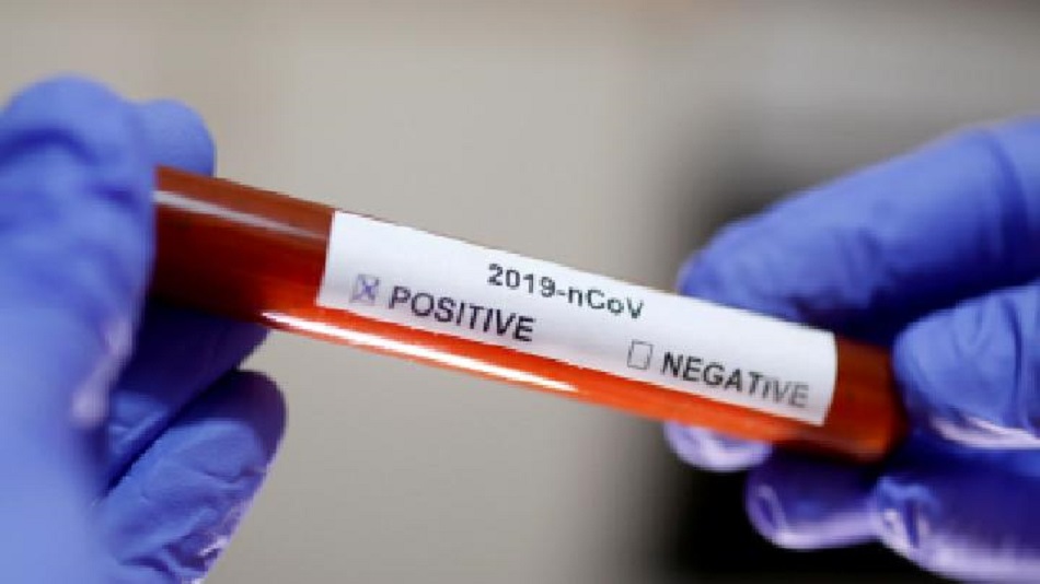 Ilustrasi Positif Covid-19 © REUTERS