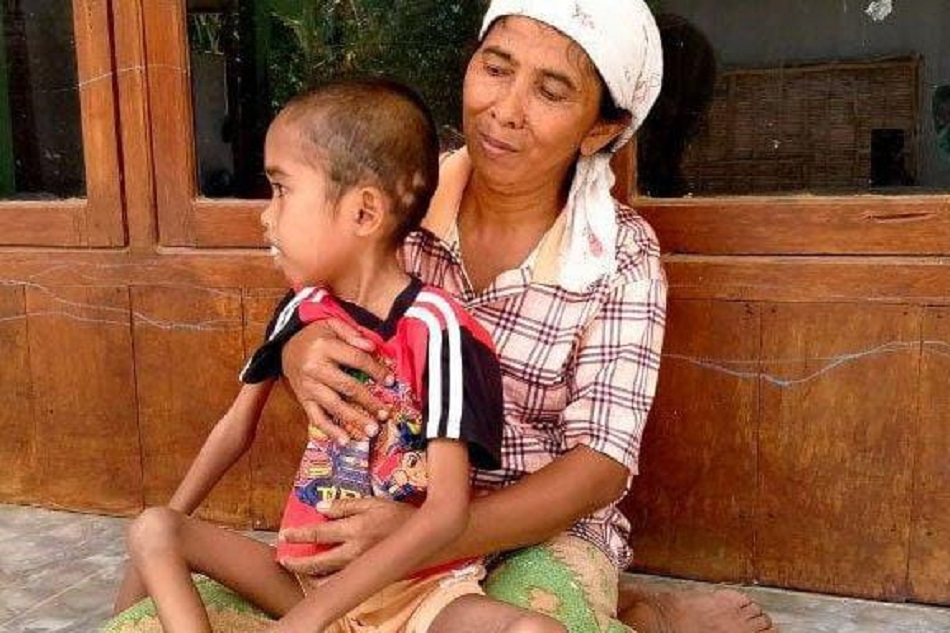 Mengidap penyakit Akut Flacyd Paralisis (APF) atau lumpuh sejak lahir. (Foto: Serikat News)