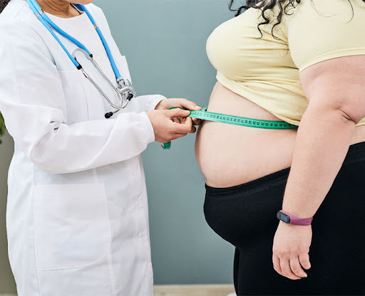 Ilustrasi pengukuran lingkar perut untuk mengetahui kondisi obesitas. (Foto: Net) 