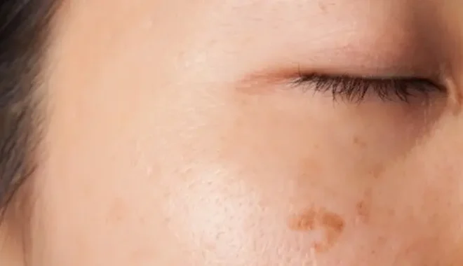 Perang AS-Iran Mengubah Arus Lanskap Dunia, Posisi Indonesia Di Bawah Kepemimpinan Prabowo-Gibran?