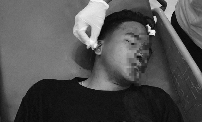 Riski Ramadani, warga Jalan Patiunus, Kelurahan Mayangan menjadi korban pemukulan sekelompok gengster. (Foto: Serikat-News)