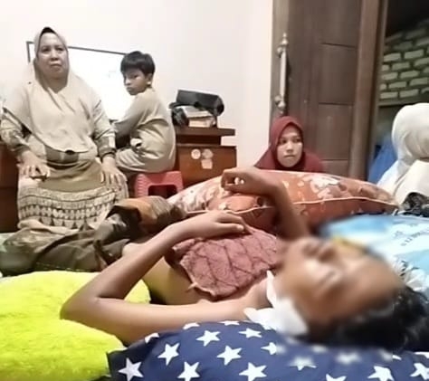 AL (17), seorang santri pondok pesantren di Kecamatan Batumarmar, Pamekasan, diduga menjadi korban penganiayaan hingga mengalami luka lebam dan retak tulang belakang. (Foto: MKR) 